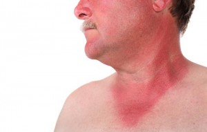 Bronceado saludable